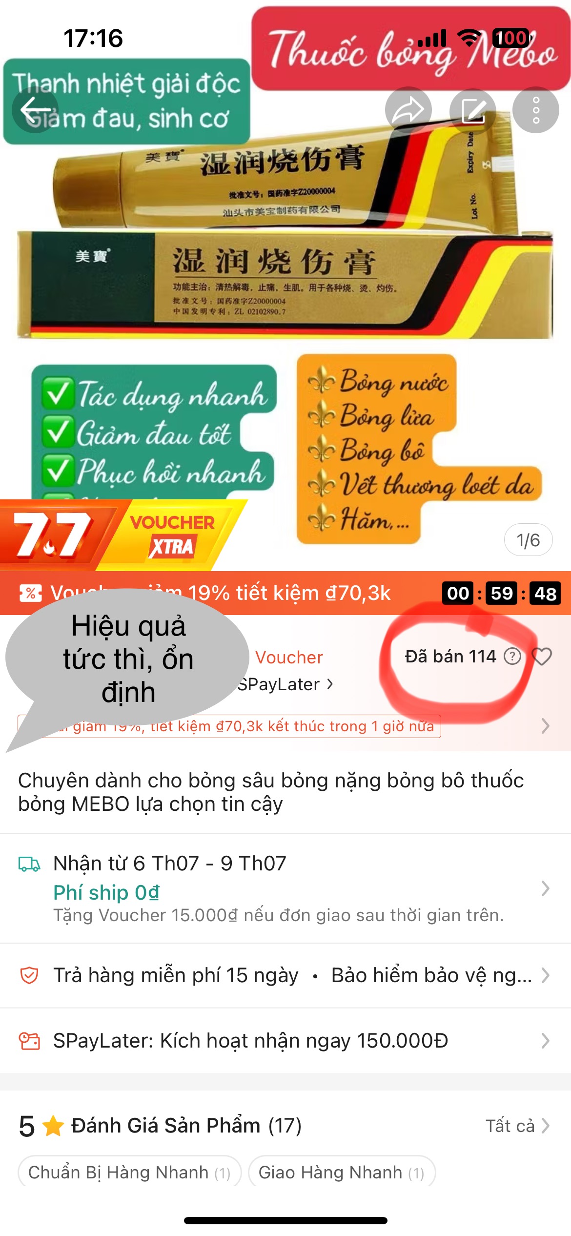 chuyên dành cho bỏng sâu bỏng nặng bỏng bô! Bán chạy số 1 Shopee THUỐC BỎNG MEBO giảm đau rát ngừa sẹo bỏng - Ảnh 2
